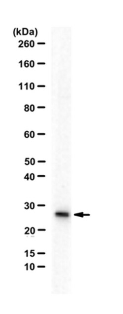 MilliporeSigma anti-RBPMS, Polyclonal 100&mu;g, Unlabeled:Antibodies, Polyclonal